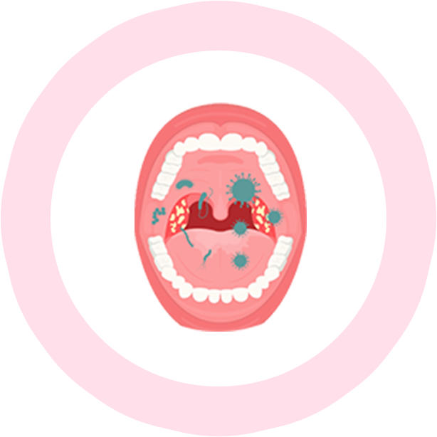 Over 700 different bacterial species has been found in the oral cavity.